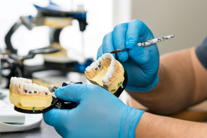 Comment les prothèses dentaires sont-elles fabriquées ?